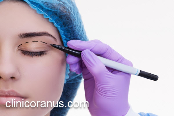 کلینیک تخصصی بلفاروپلاستی در غرب تهران | کلینیک اورانوس