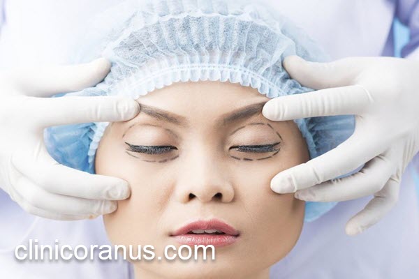 بهترین کلینیک بلفاروپلاستی در تهران | کلینیک اورانوس