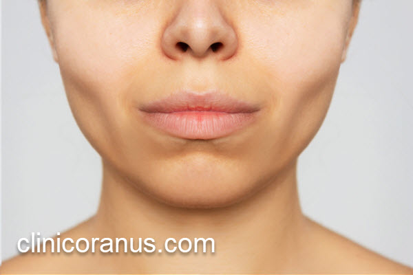 بهترین مرکز بوکال فت در جنت آباد | کلینیک اورانوس