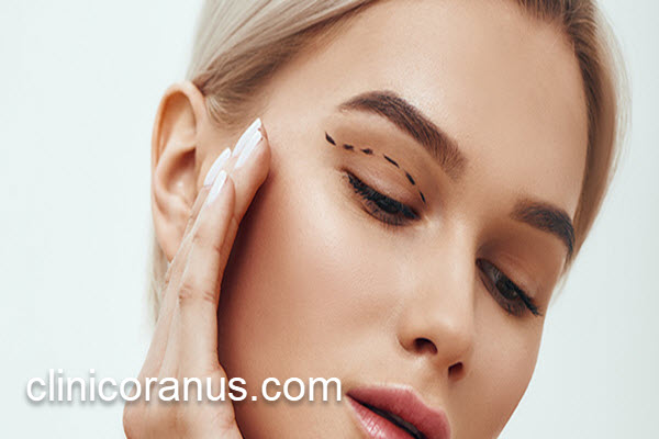 بررسی عمل بلفاروپلاستی پلک بالا | کلینیک اورانوس