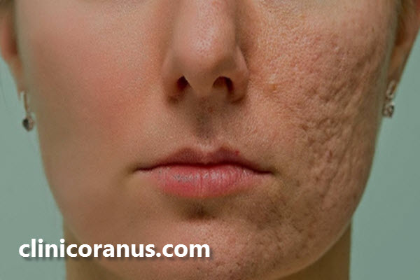 سابسیژن چه کاربردی دارد؟