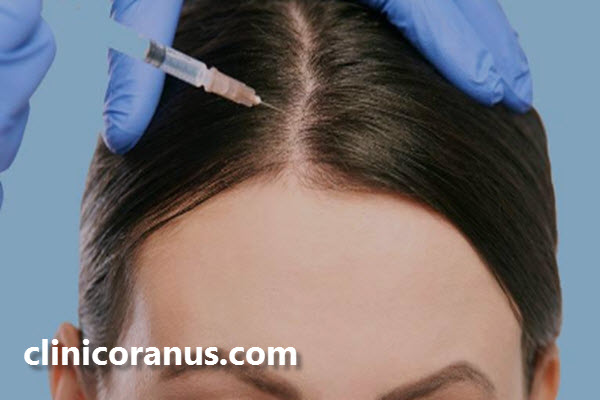 قیمت مزوتراپی مو چقدر است؟