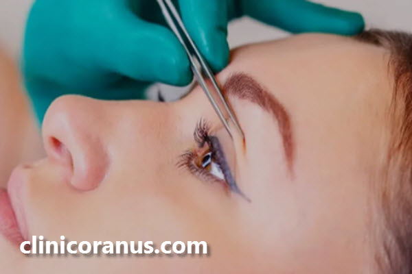 بلفاروپلاستی چیست؟