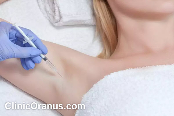 کاربرد بوتاکس زیر بغل | کلینیک اورانوس