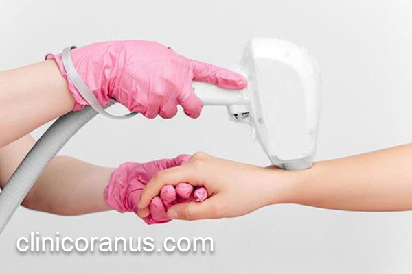 لیزر موهای زائد کل بدن در مرکز معتبر | کلینیک اورانوس