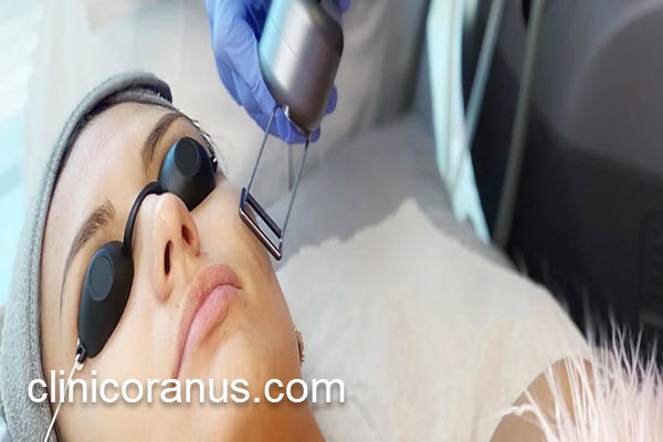 تعداد جلسات درمان با لیزر co2 فرکشنال | کلینیک اورانوس