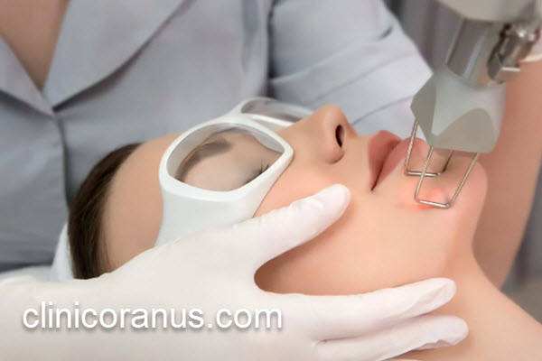 آشنایی با تعداد جلسات درمان با لیزر co2 فرکشنال | کلینیک اورانوس