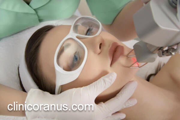 تعداد جلسات لیزر فرکشنال در بهترین کلینیک زیبایی | کلینیک اورانوس