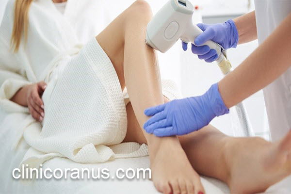 قیمت لیزر موهای زائد در سال 1404 | کلینیک اورانوس