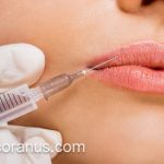 تزریق فیلر لب در کلینیک تخصصی | کلینیک اورانوس