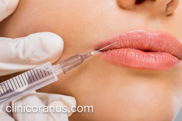 تزریق فیلر لب در کلینیک تخصصی | کلینیک اورانوس