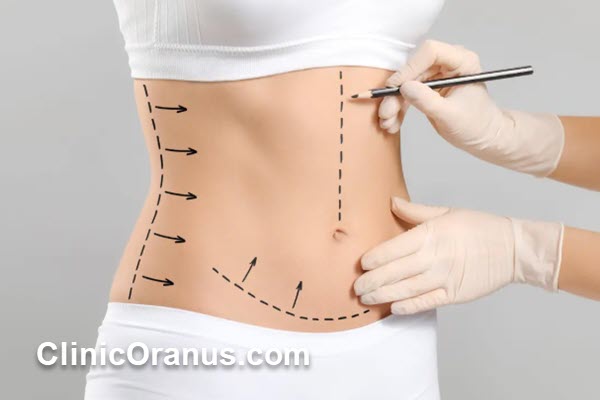 مراقبت های پس از پیکرتراشی