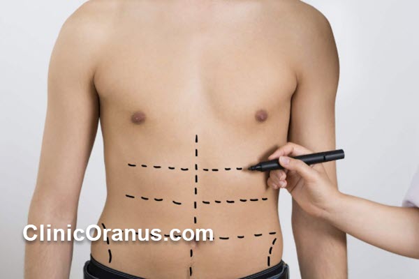 نحوه عمل لیپوماتیک چگونه است؟