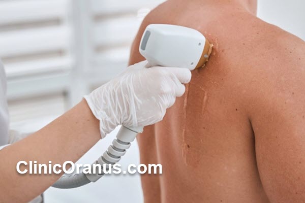 مرکز لیزر با دستگاه الکساندرایت در تهران