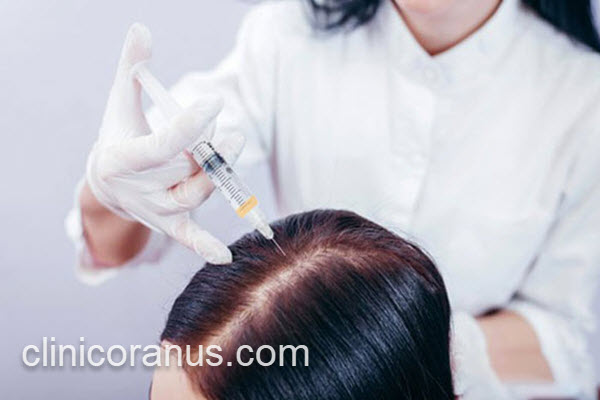 هزینه و قیمت پی آر جی اف مو | کلینیک اورانوس