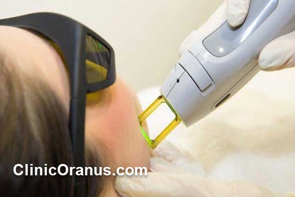 الکساندرایت کندلا چیست و چرا بهترین انتخاب برای لیزر موهای زائد است؟