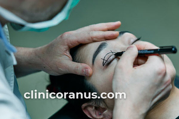 هزینه عمل بلفاروپلاستی در غرب تهران چقدر است؟