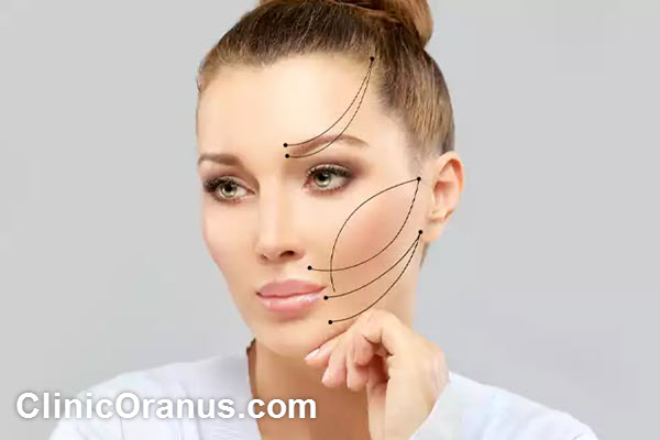 ویژگی های بهترین دکتر لیفت صورت با نخ در غرب تهران