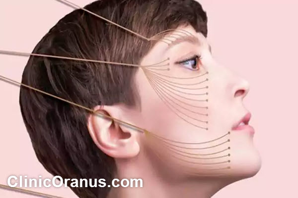 the-best-thread-face-lift-doctor-in-west-tehran-clinicoranus.com بهترین دکتر لیفت صورت با نخ در غرب تهران