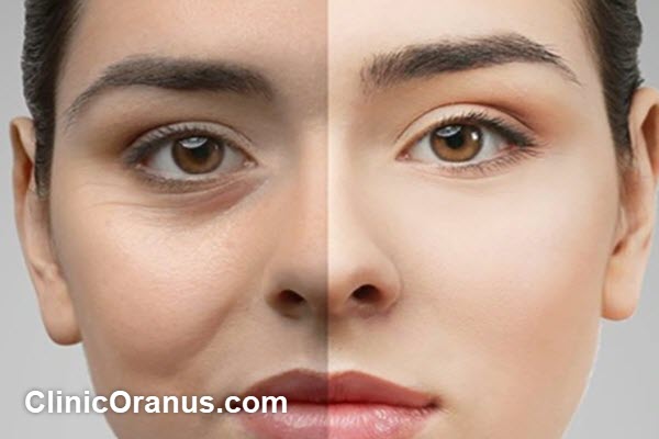نکات مهم در پیش از و پس از عمل