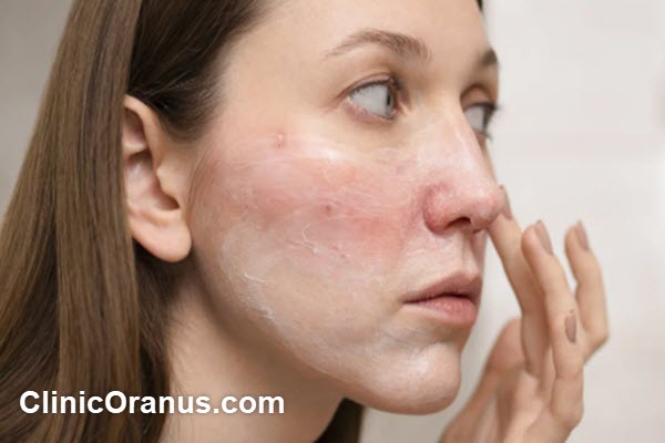 dermatologist-in-west-tehran-clinicoranus.com متخصص بیماری های پوست در غرب تهران