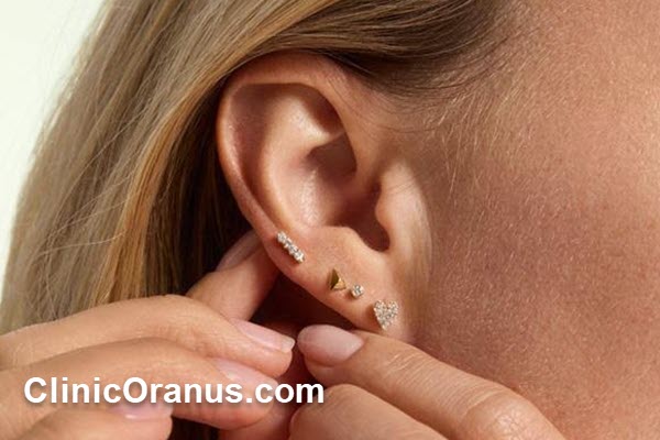 چرا کلینیک اورانوس بهترین مرکز پیرسینگ در غرب تهران است؟