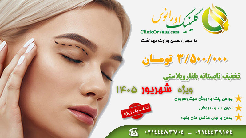 تخفیف ویژه بلفاروپلاستی تابستان 1405 - شهریور ماه