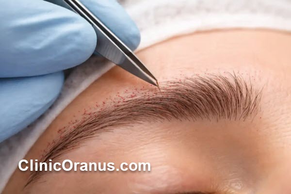 بهترین روش کاشت ابرو برای ابروهای کم پشت کدام است؟