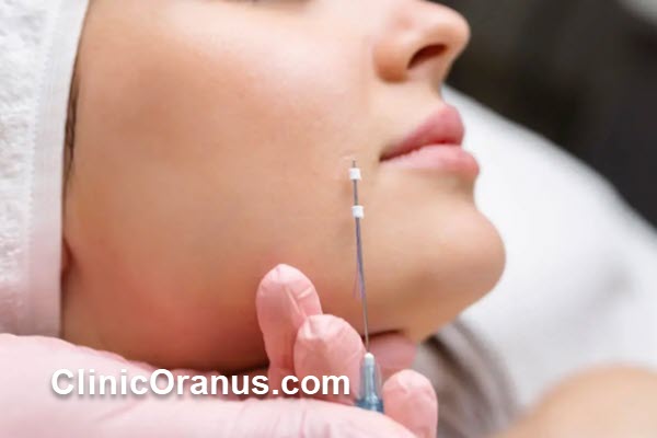 فیلر PLLA برای چه افرادی مناسب است؟